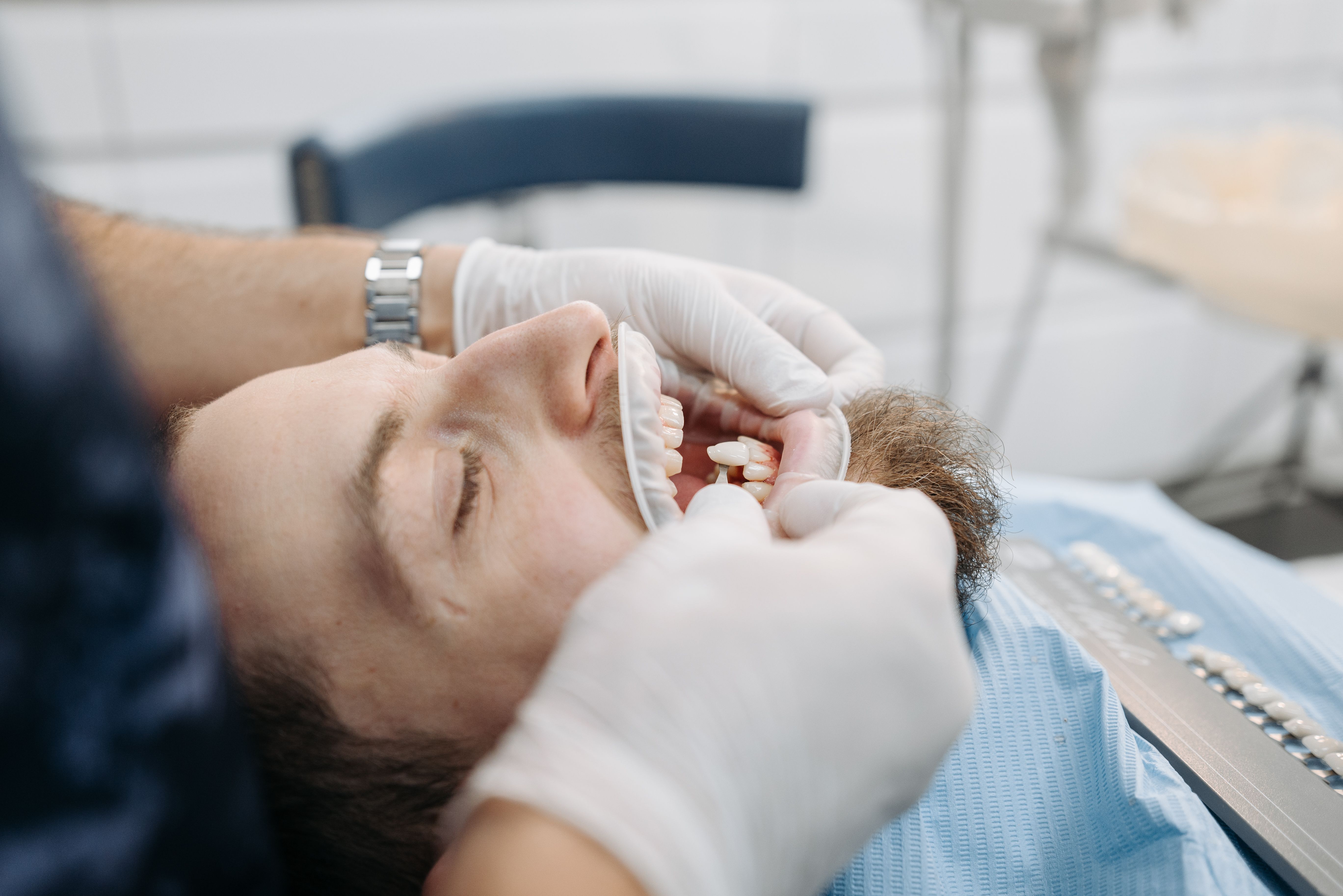 Dentist matching a shade guide during a patient examination